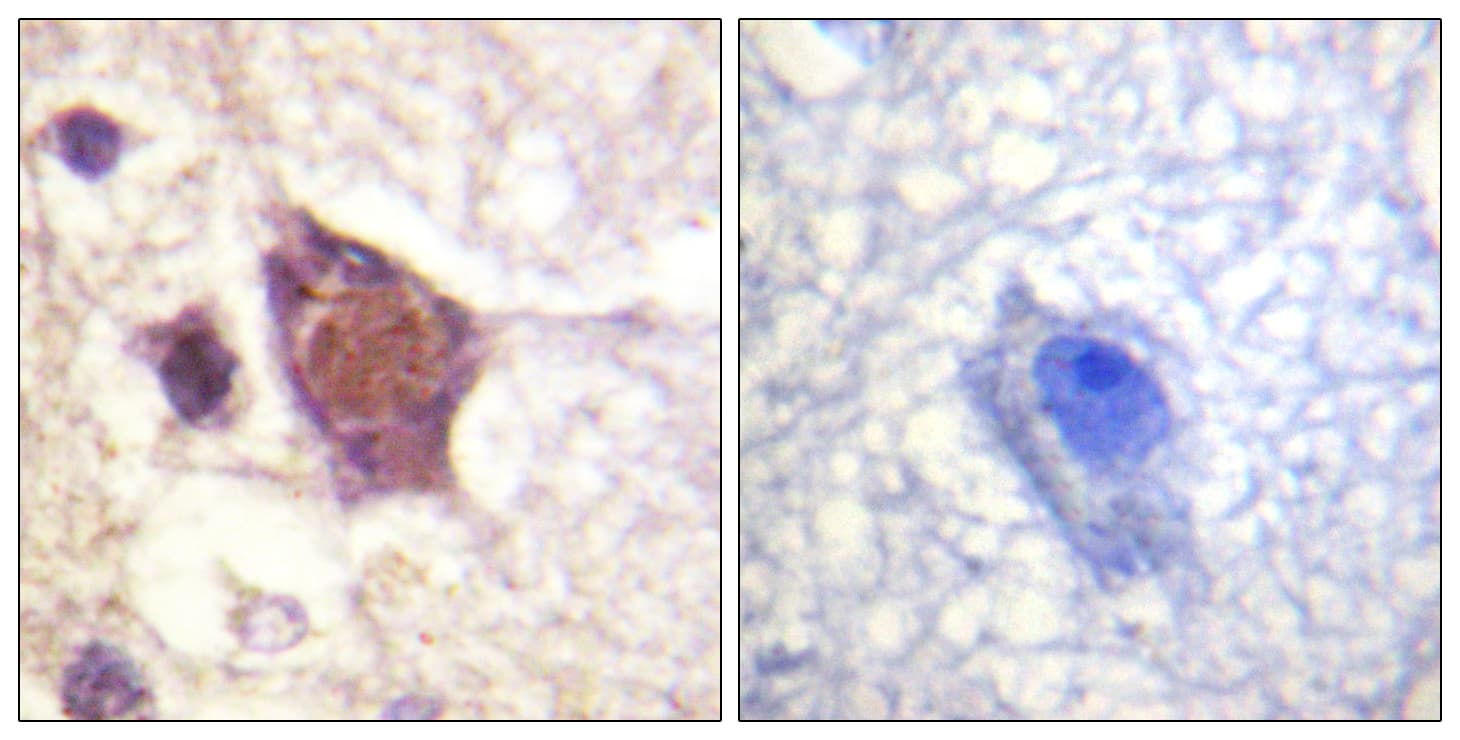 DDX3 / DDX3X Antibody (phospho-Thr322)