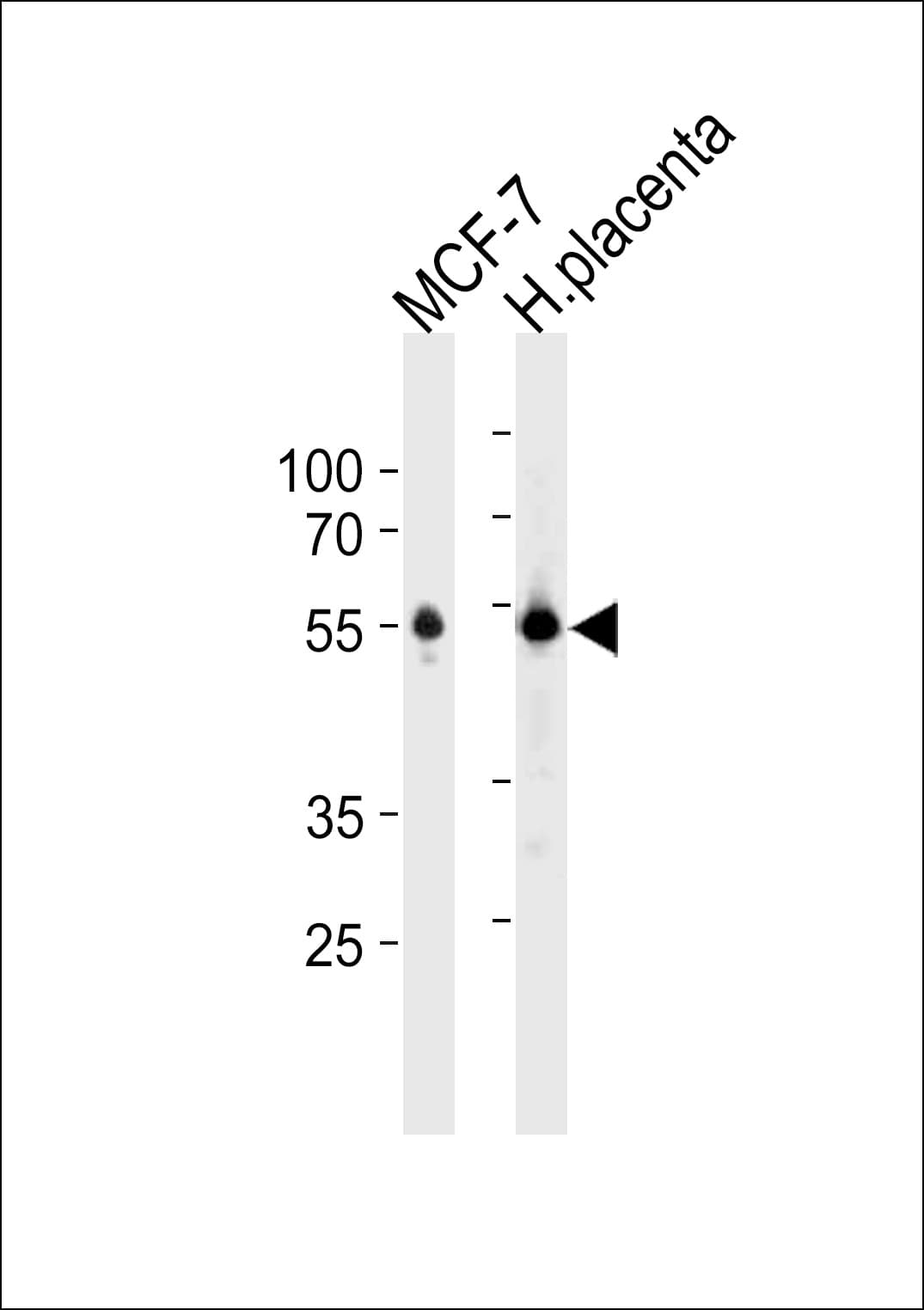 ESR2 / ER Beta Antibody (aa451-480)