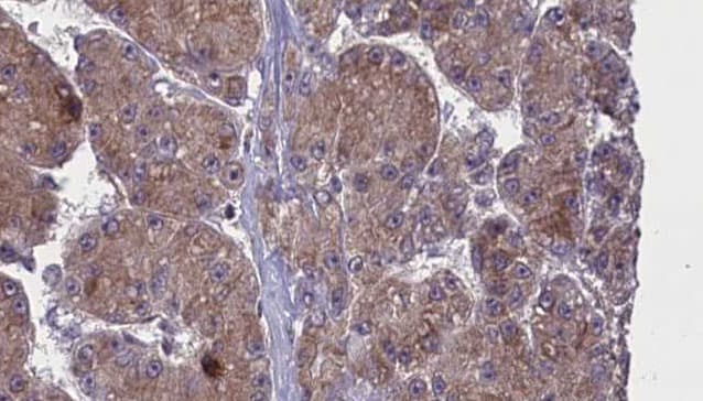 OR52N2 Antibody