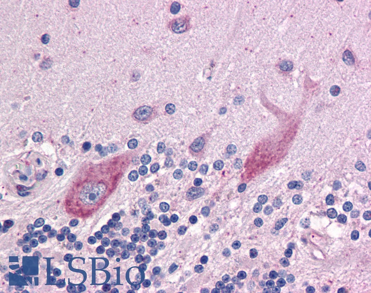 IHC-plus™ Requiem / DPF2 Antibody (clone 2F6)