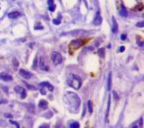 SPP1 / Osteopontin Antibody (clone 1B20, Biotin)