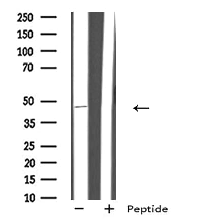 GPR151 Antibody