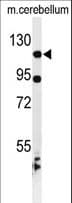 KIF6 Antibody (aa34-62)