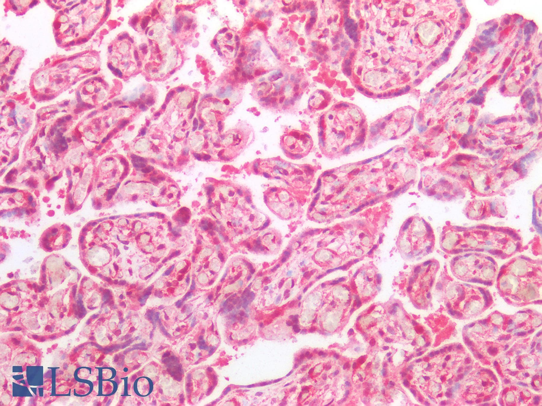 IHC-plus™ Polyclonal Rabbit anti-Human STMN1 / Stathmin / LAG Antibody (IHC, IF, WB)