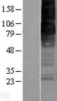 OX2R / Orexin Receptor 2 Protein (Over-Expression Lysate Myc-DDK (Flag))