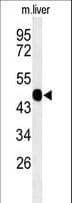WAS / WASP Antibody (aa116-144)