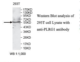 PLRG1 Antibody (aa241-451)