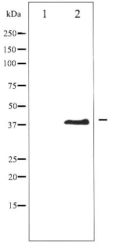 Polyclonal Rabbit anti-Human AURKB / Aurora-B Antibody (phospho-Thr232, IHC, IF, WB)