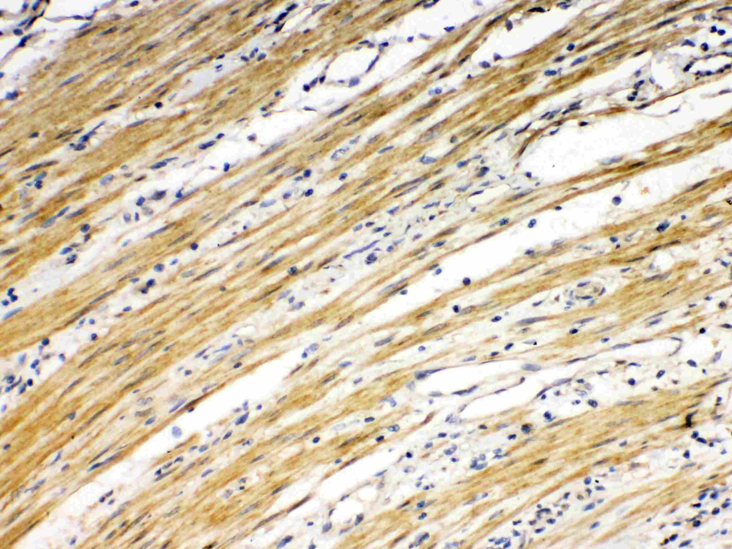 TNFRSF10B / Killer / DR5 Antibody