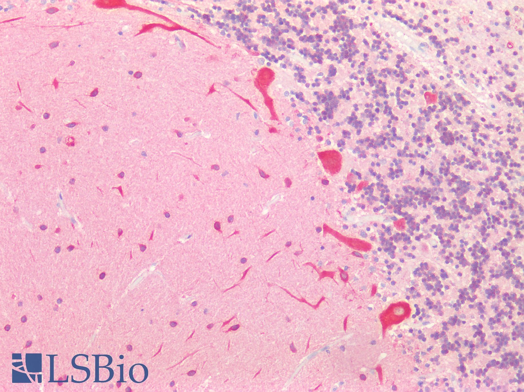 Polyclonal Rabbit anti-Mouse MAP1L / MAP1A Antibody (aa2552-2759, IHC, WB)