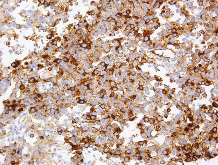 Monoclonal Mouse anti-Human TAG-72 Antibody (clone AHC0242, Ready-to-Use, IHC, WB)