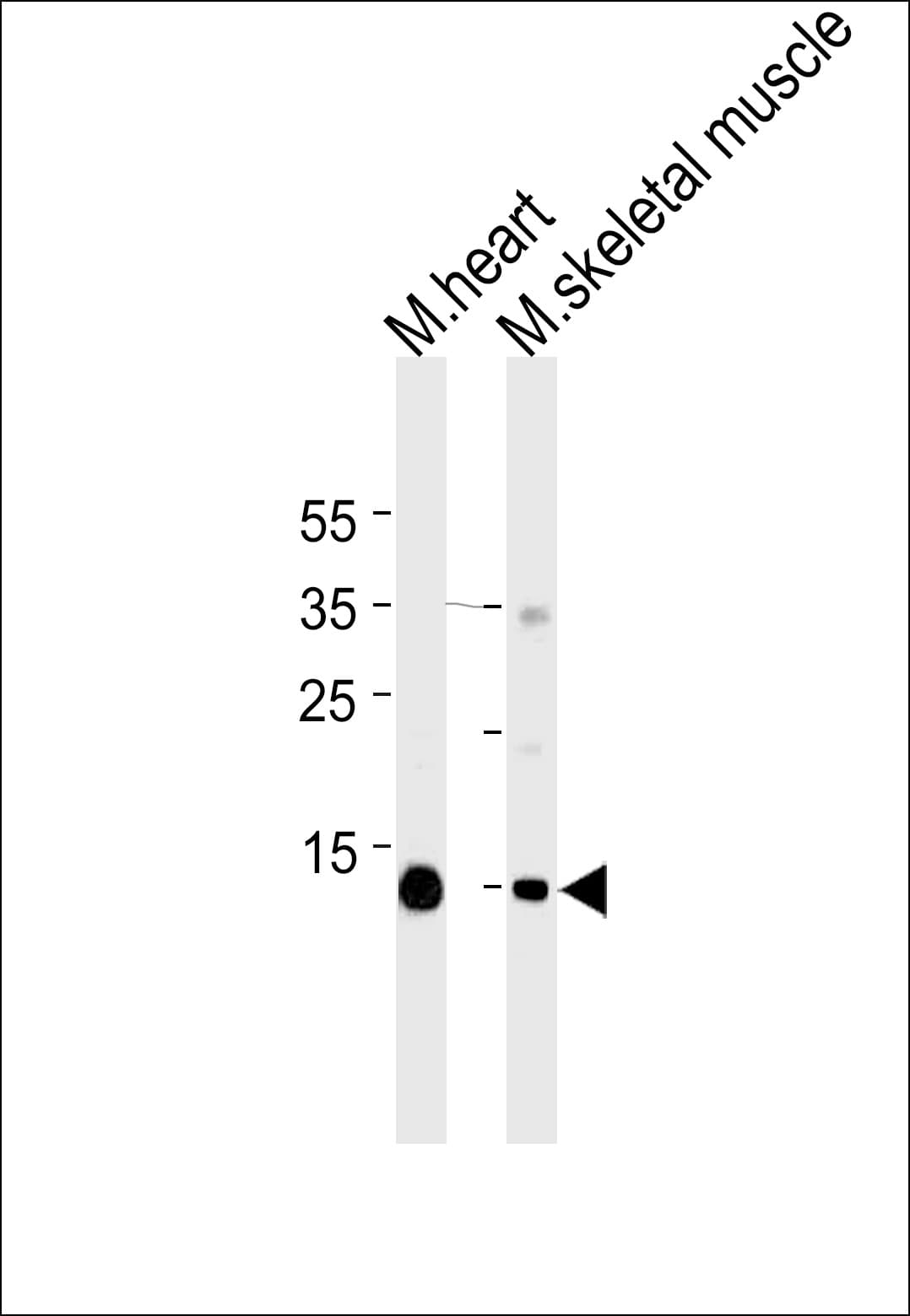 MB / Myoglobin Antibody (aa118-150, clone 773CT18.2.2)