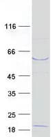 Human FBXW11 Protein (Recombinant Myc-DDK (Flag))