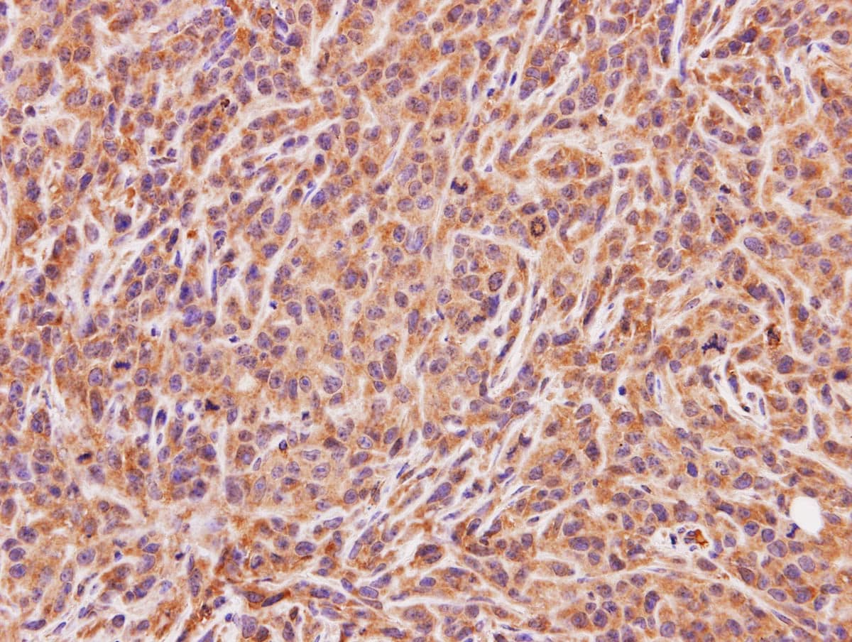 Polyclonal Rabbit anti-Human ACMSD Antibody (aa105-336, IHC, WB)