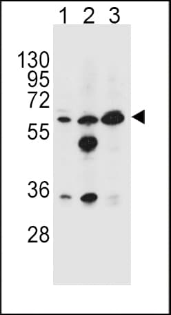Polyclonal Rabbit anti-Human GATM / AGAT Antibody (aa58-84, IHC, WB)