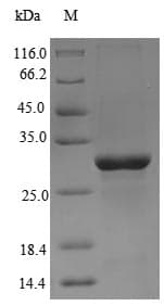 Chicken ANOS1 / Anosmin Protein (Recombinant 6His, N-terminus)