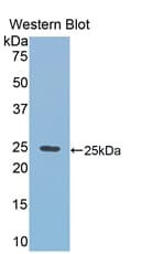 RIP1 / RALBP1 Antibody (aa192-380)