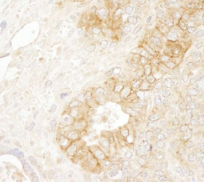 CTNNB1 / Beta Catenin Antibody (aa760-781)