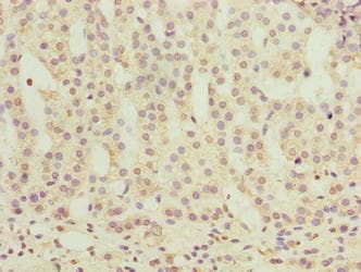 OR2H1 Antibody