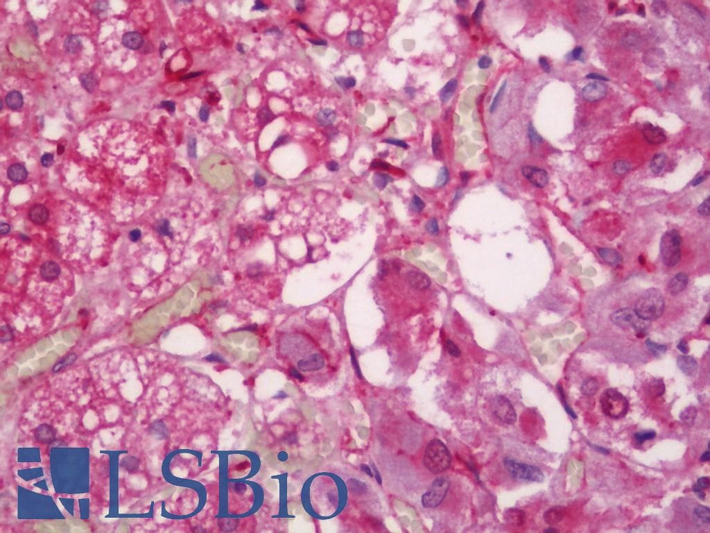 IHC-plus™ S100A10 Antibody (aa3-52)