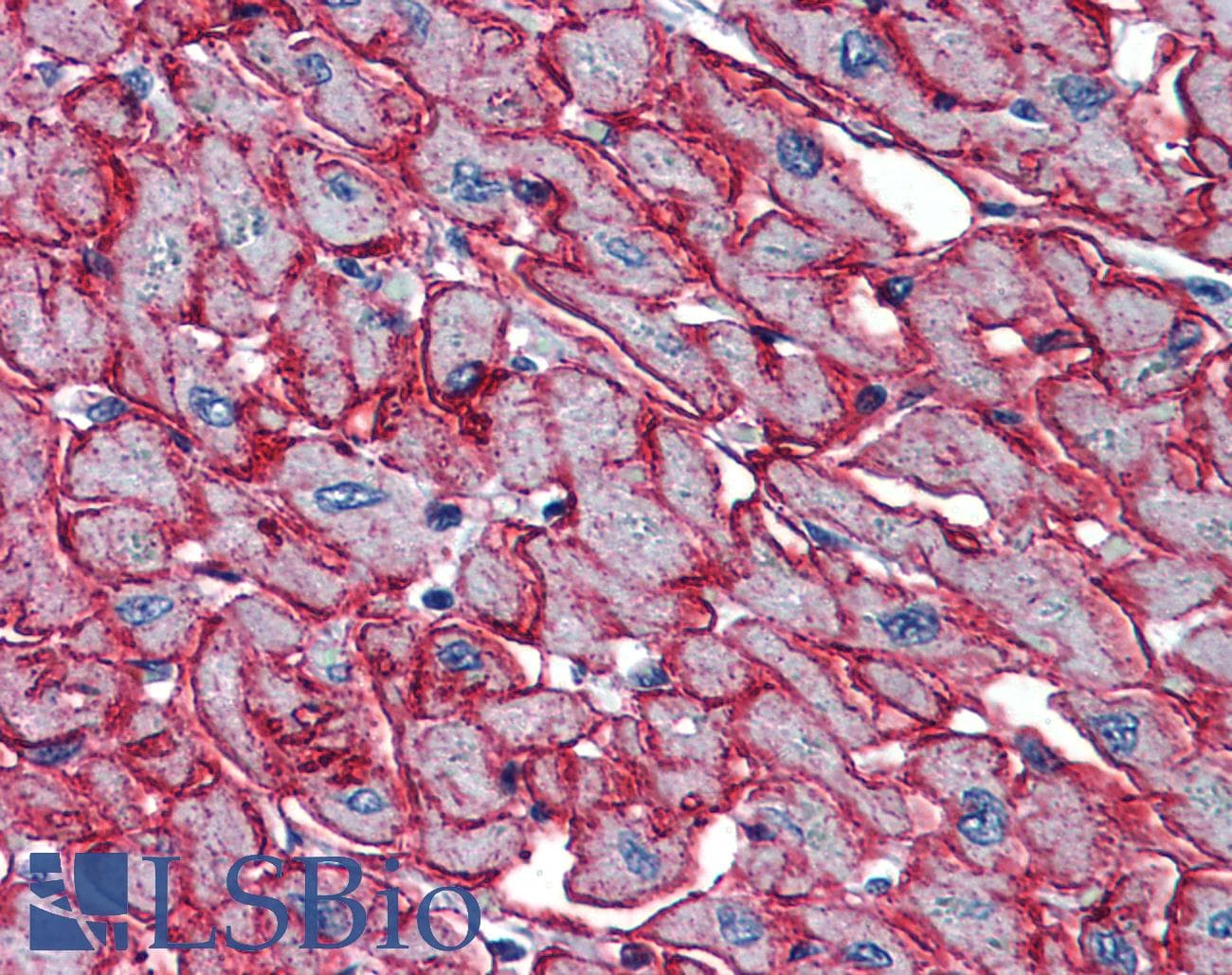 IHC-plus™ PSMB4 Antibody (clone 6G7-E8)