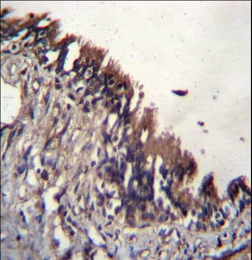 Polyclonal Rabbit anti-Human NUDT9 Antibody (aa318-346, IHC, WB)