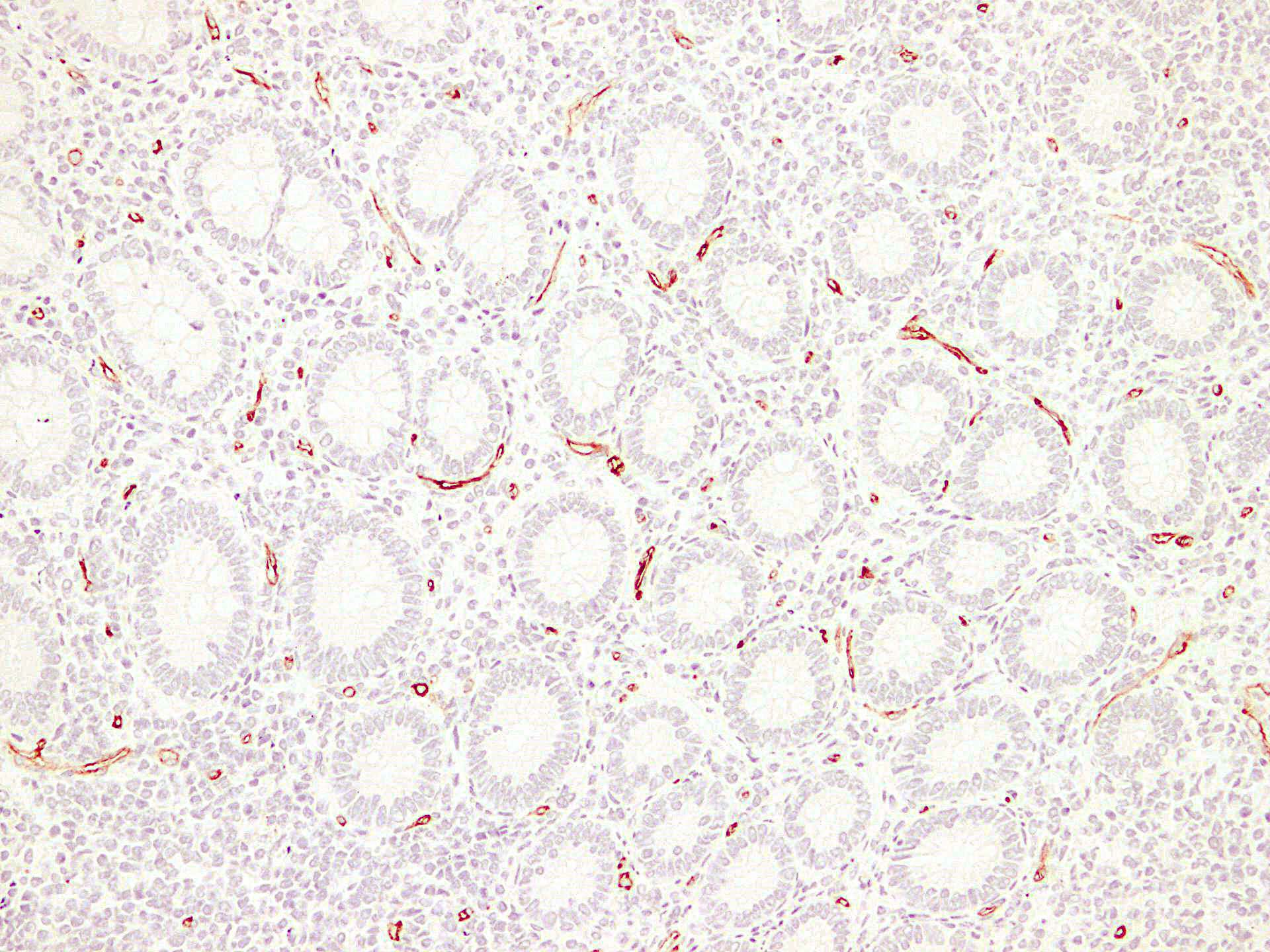 IHC-plus™ CD34 Antibody (clone ABT-CD34)