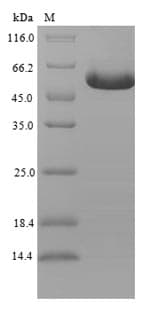Human GFRAL Protein (Recombinant 6His-SUMO, N-terminus)