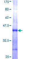 Human CTRL Protein (Recombinant GST, N-terminus)