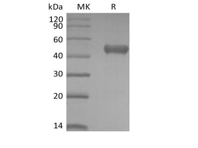 Human PVRIG Protein (Recombinant Mouse IgG Fc, C-terminus)