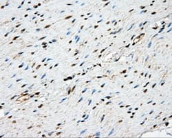 Monoclonal Mouse anti-Human NME4 Antibody (clone OTI1C11, IHC, IF, WB)