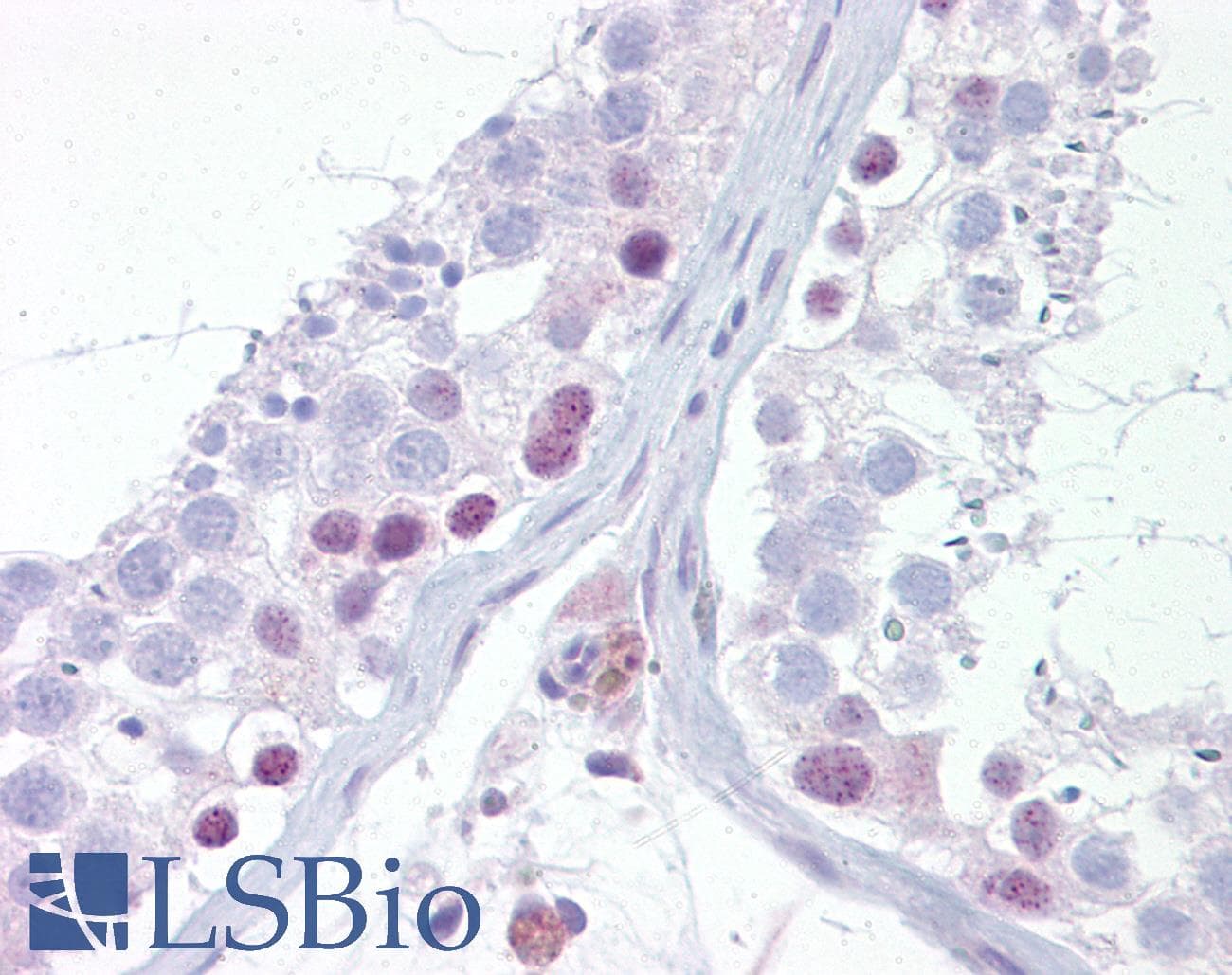 UTF1 Antibody (aa251-300)