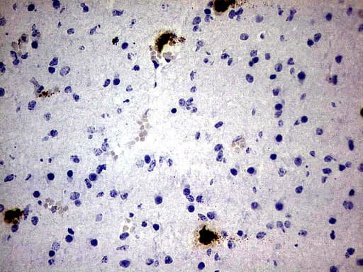 Monoclonal Mouse anti-Human S100A9 / MRP14 Antibody (clone UMAB173, Carrier-free, IHC, IF, WB)