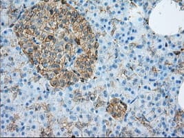 ALDH3A1 Antibody (clone 1B6, Carrier-free)
