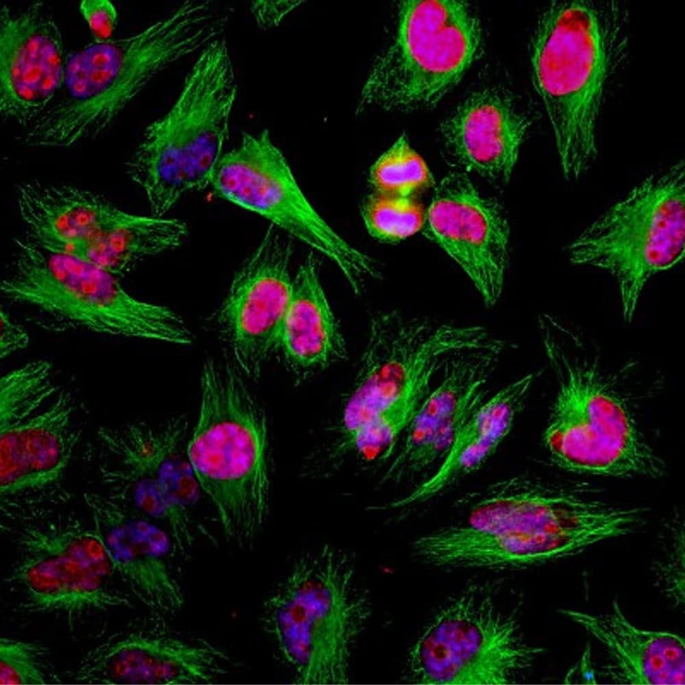 MKI67 / Ki67 Antibody