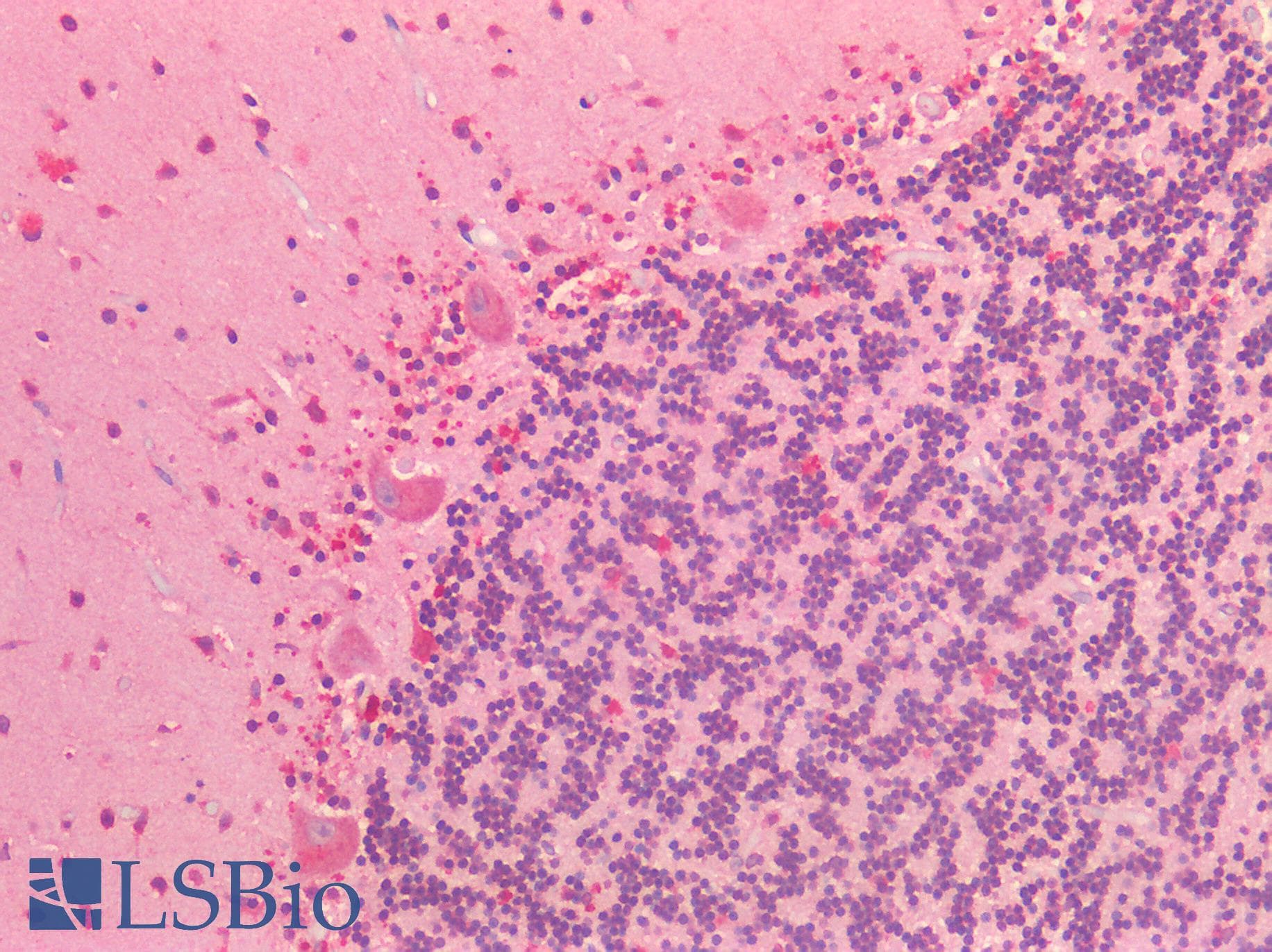 IHC-plus™ NOTCH2 Antibody