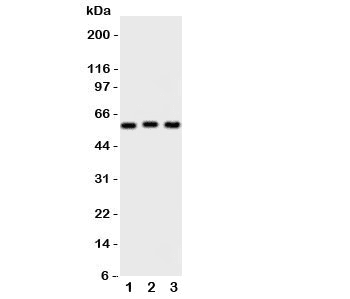Polyclonal Rabbit anti-Human PKM / Pyruvate Kinase, Muscle Antibody (WB)