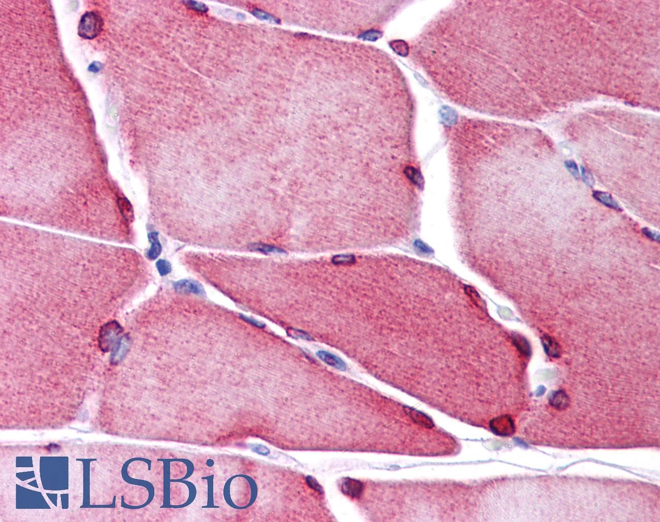 IHC-plus™ TMEM38A Antibody