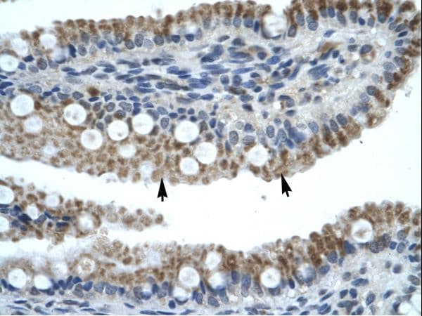 ZNF683 Antibody (aa89-138)