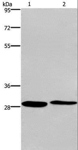 NAR / CPSF4 Antibody