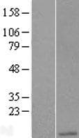 ANAPC11 / APC11 Protein (Over-Expression Lysate Myc-DDK (Flag))