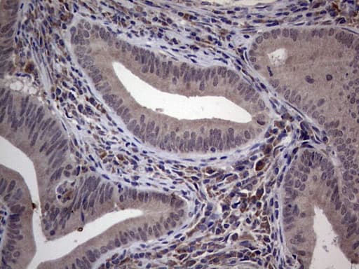 MDM2 Antibody (aa119-438, clone OTI3F1)