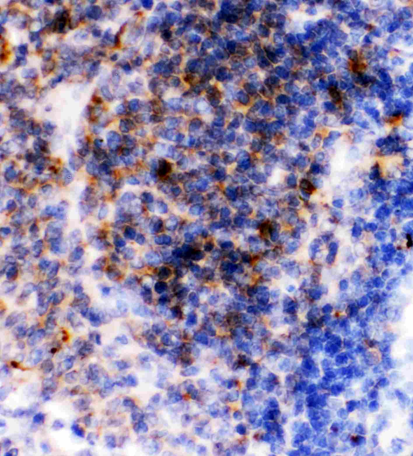 FCER2 / CD23 Antibody (aa50-331)
