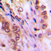 AURKA / Aurora-A Antibody (C-Terminus)