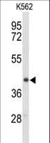 ENTPD2 Antibody (aa86-113)