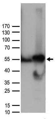 Polyclonal Rabbit anti-Human CCNA2 / Cyclin A2 Antibody (WB)