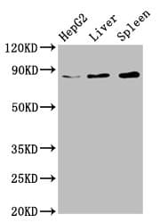 NSUN2 Antibody