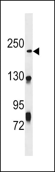 NHSL1 Antibody (aa632-661)