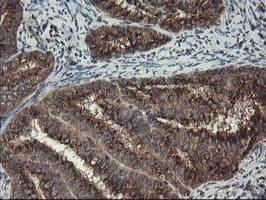 GCP60 / ACBD3 Antibody (clone OTI1G2)