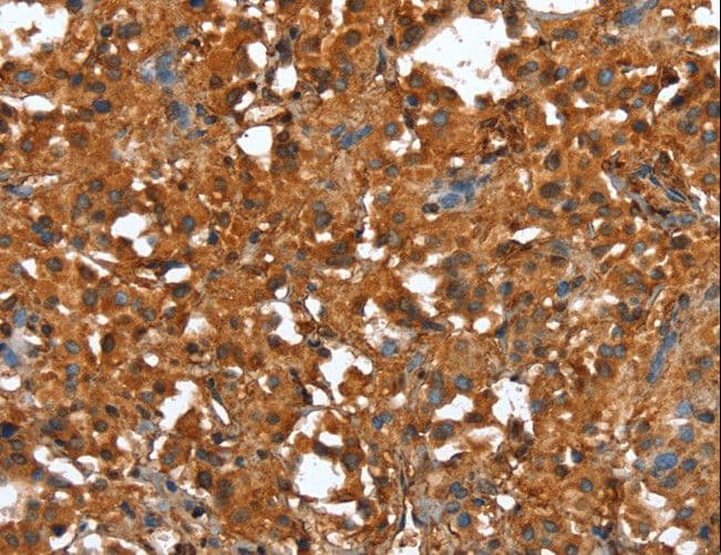 Polyclonal Rabbit anti-Human CTBP1 / CTBP Antibody (IHC, WB)